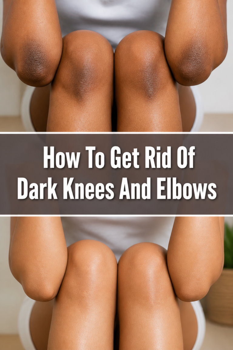 ✨ How To Get Rid Of Dark Knees And Elbows